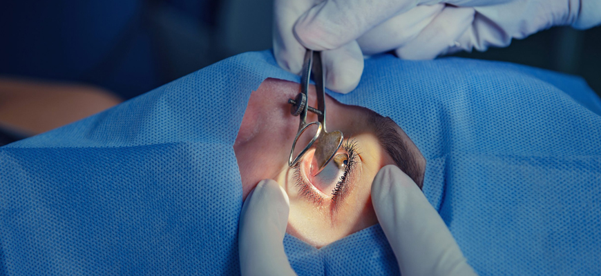 Glaucoma Care Surgery