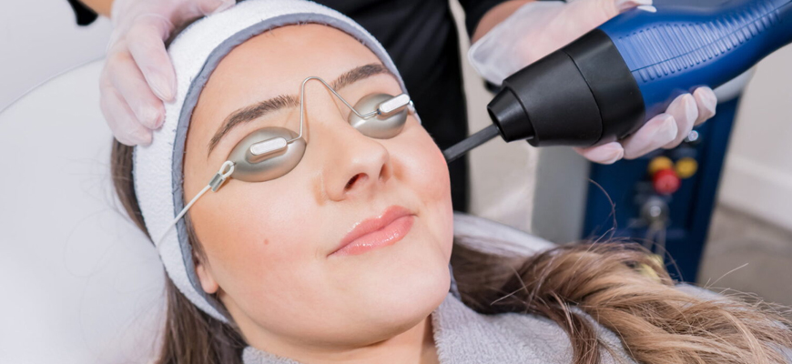 YAG Laser